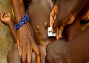 Trafic de clitoris en Côte d’Ivoire : une pratique inhumaine et alarmante à dénoncer