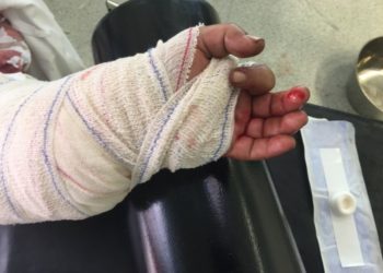 Société / Kalalé : Un homme gardé au commissariat de Dérassi pour avoir coupé la main de son rival.