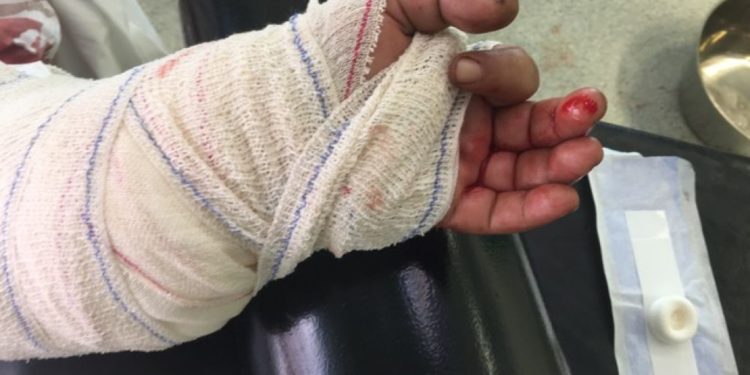 Société / Kalalé : Un homme gardé au commissariat de Dérassi pour avoir coupé la main de son rival.