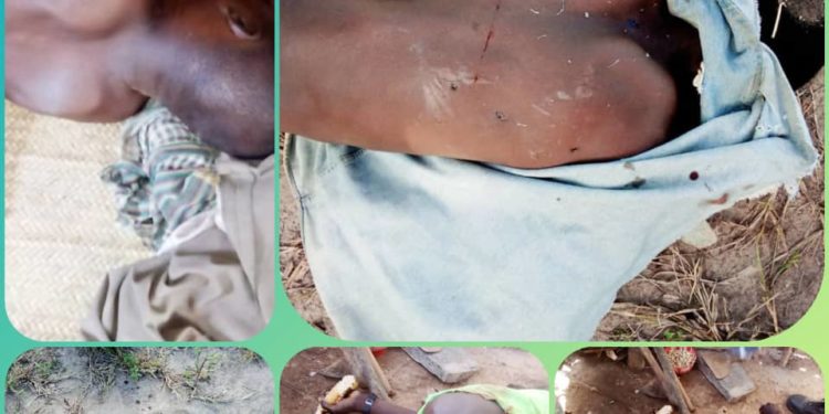 Drame : Un homme donne la mort à deux de ses frères à Banikoara.