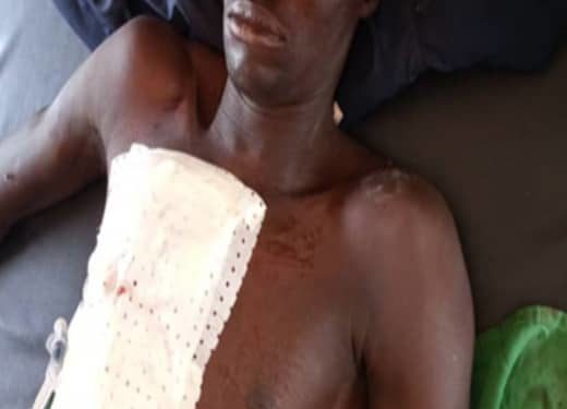 Insécurité / Kouandé : Un homme reçoit 19 balles dans la poitrine et se porte pourtant très bien