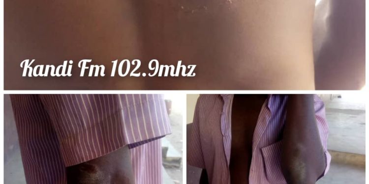 CEG 3 Kandi: Un ancien enseignant vacataire et sa femme agressent le censeur.