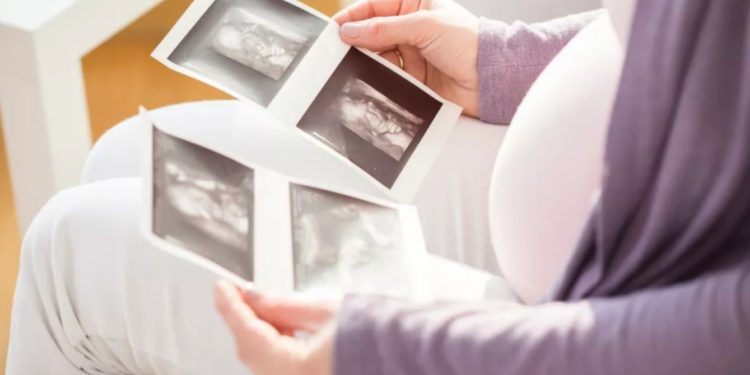 Mali : Une jeune malienne accouche 9 bébés