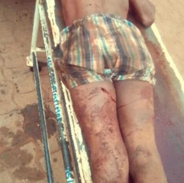 Abomey Calavi-Insécurité : 5 malfrats tués dans un échange de tirs avec la Police Républicaine.