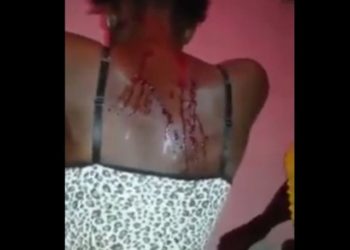 Drame : Une femme bastonnée par son mari à coup de machette à Ouénou .