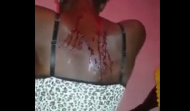 Drame : Une femme bastonnée par son mari à coup de machette à Ouénou .