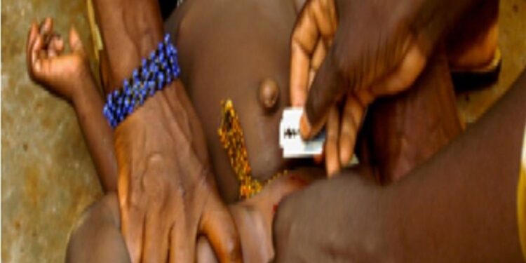 Trafic de clitoris en Côte d’Ivoire : une pratique inhumaine et alarmante à dénoncer