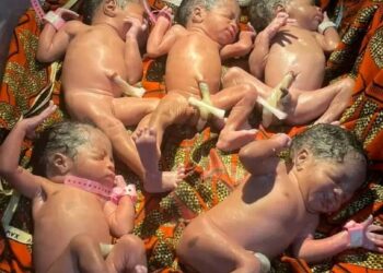 Djougou : Une mère donne naissance à un quintuplé