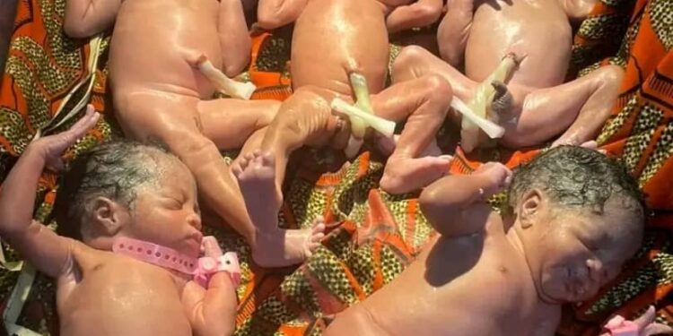 Djougou : Une mère donne naissance à un quintuplé